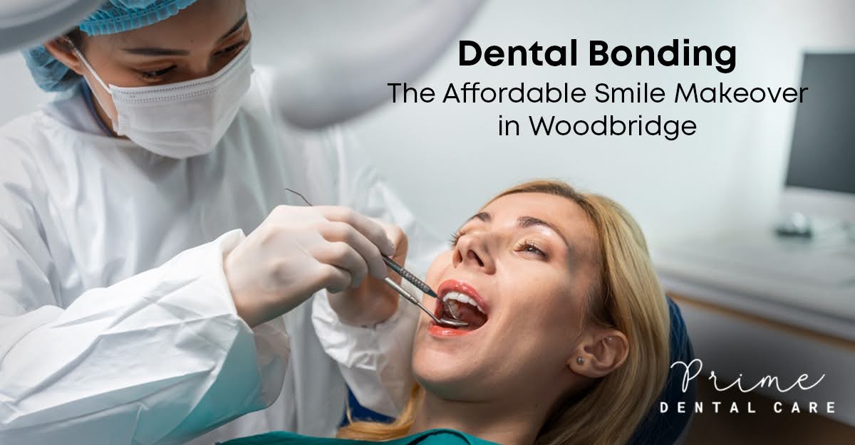 Dental Bonding for Affordable Smile Makeover in Woodbridge